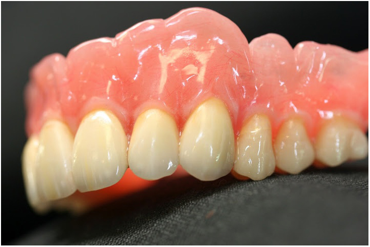 implantes