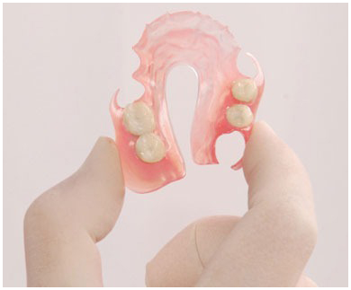 implantes